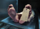 Cadavre prêt à entrer en chambre froide (Istock)